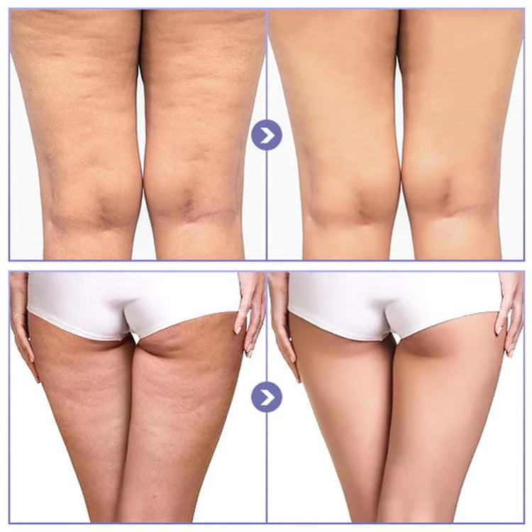 Thigh Anti-Chafing Patches – Invisible Ultra-Thin Leg Protection Stickers
