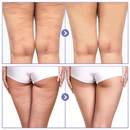 Thigh Anti-Chafing Patches – Invisible Ultra-Thin Leg Protection Stickers